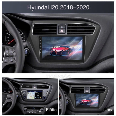 Hyundai i20 2018- 2020 9" Android multimédia autórádió érintőkijelzős fejegység – másik nézet